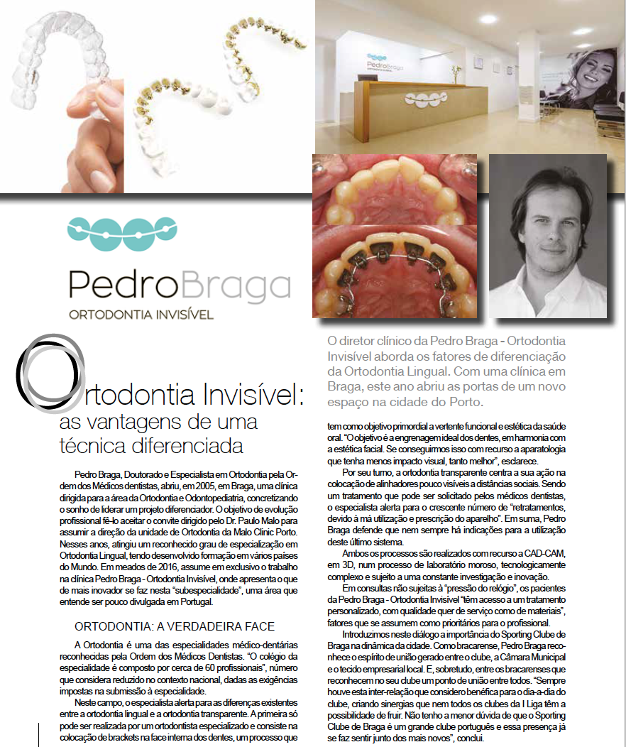 Ortodontia Invísivel: vantagens de uma técnica diferenciadora
