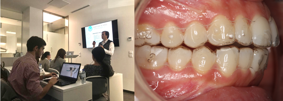 Curso Alinhadores Dentários Smilers