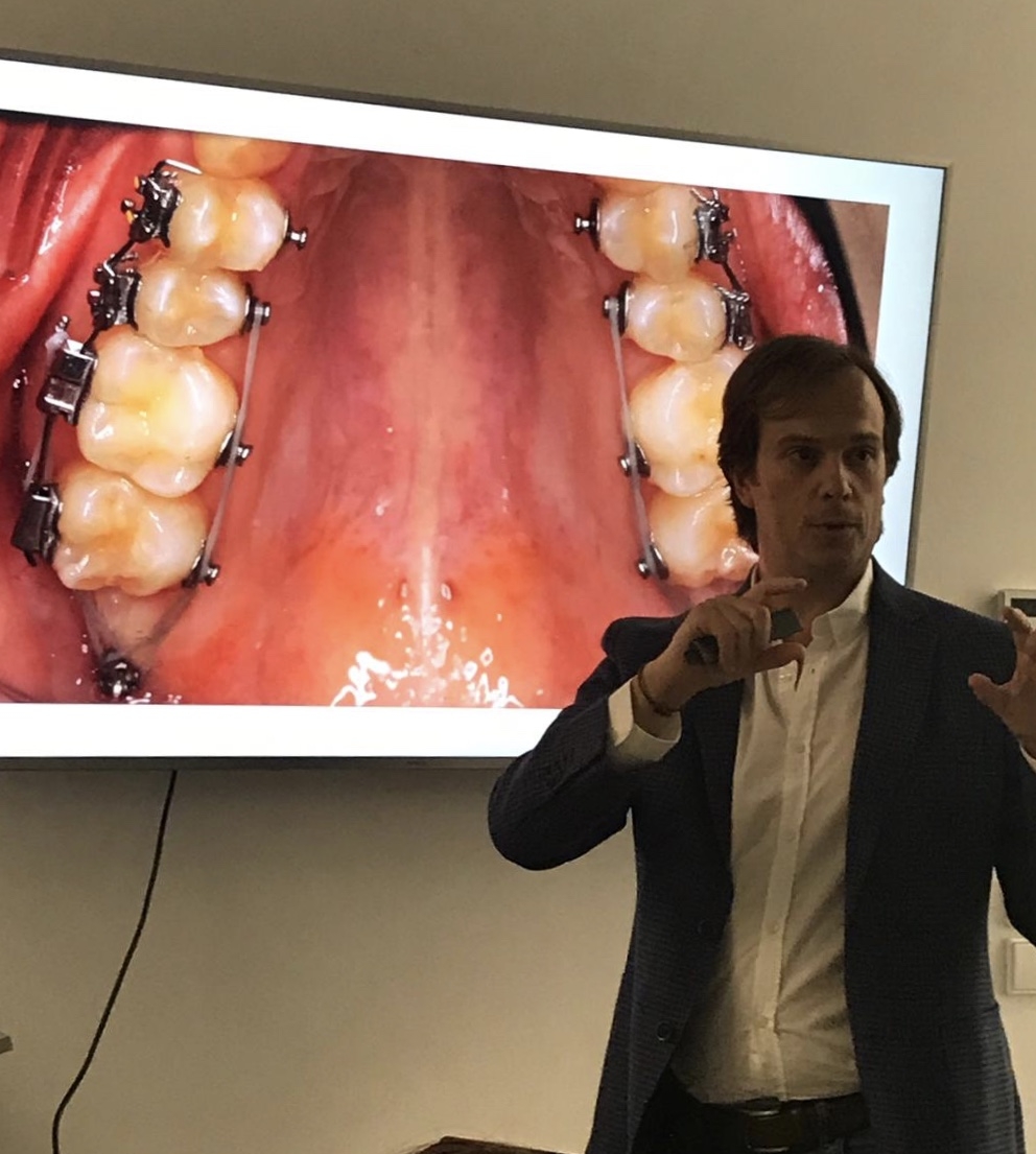 Curso Ancoragem Esquelética em Ortodontia