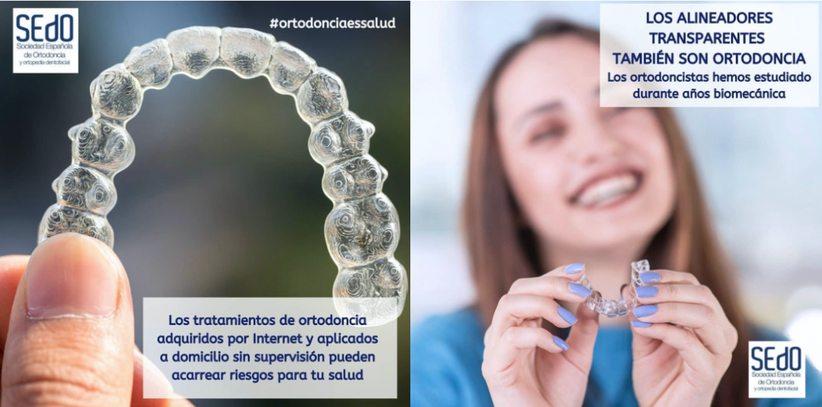 Tratamentos de Alinhadores Dentários pela Internet