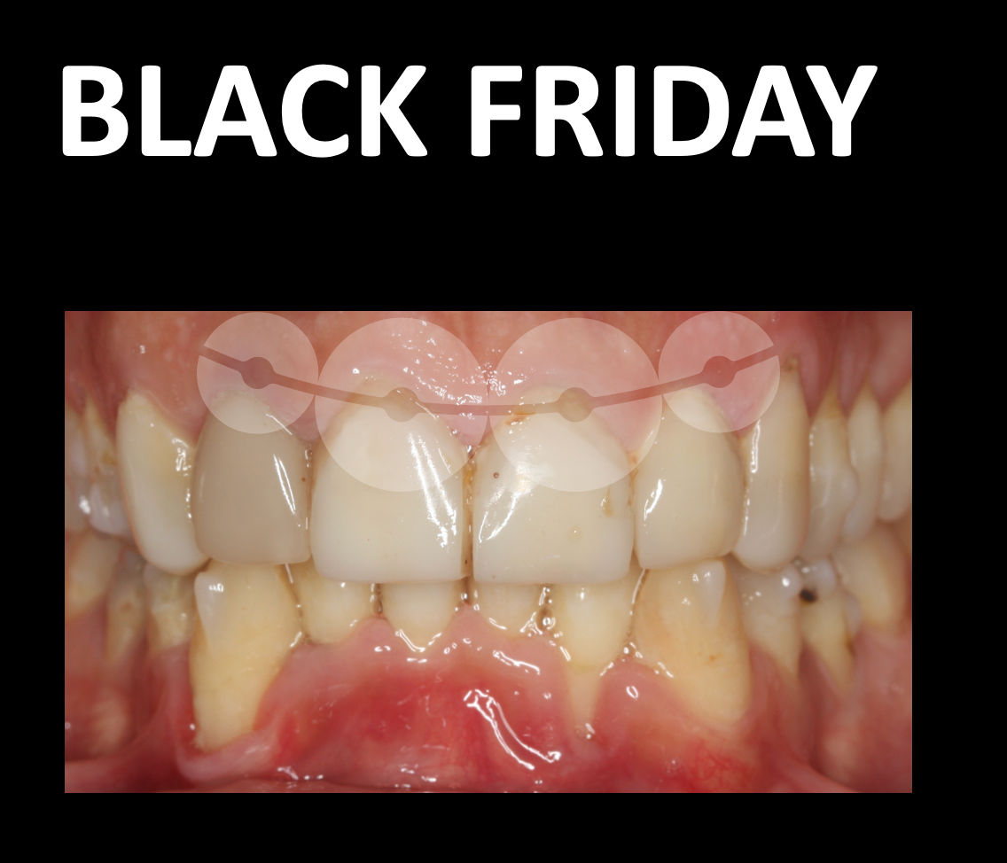 BLACK FRIDAY