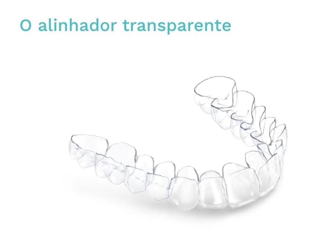 Posso usar alinhadores?