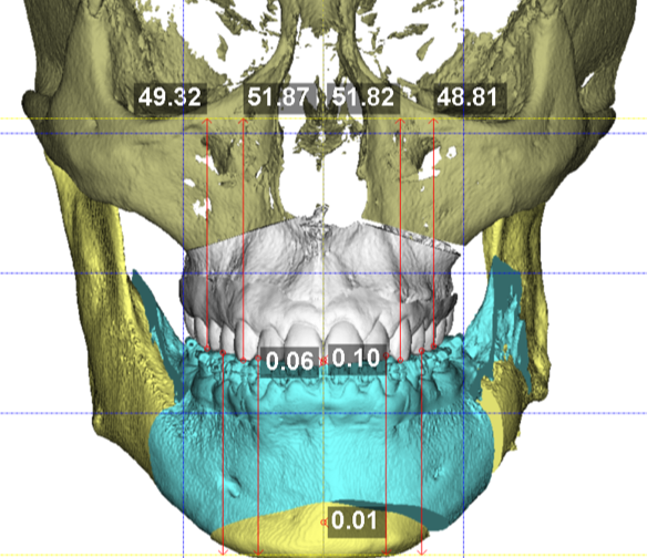 CIRURGIA MAXILOFACIAL